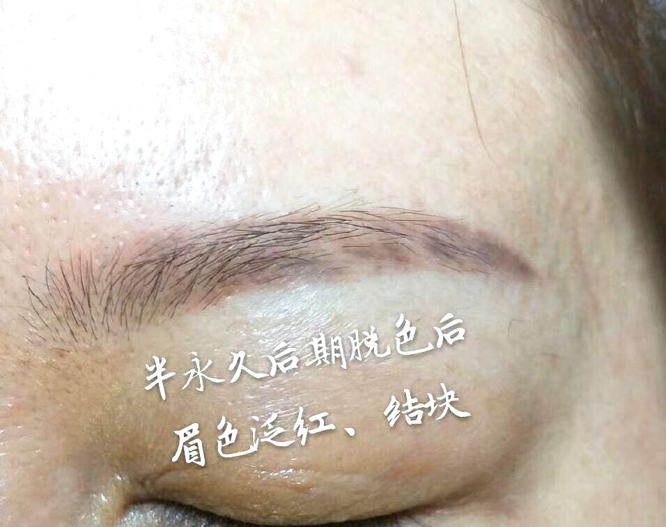 纹眉者说误区之一红眉毛蓝眉毛是纹眉色料造成的吗