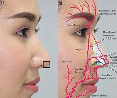 注射用玻尿酸(大家应该注意些什么)插图(2)