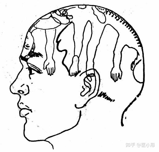 最后提出完整独立的"汤氏头针",根据中医藏象经络学说理论以及中医