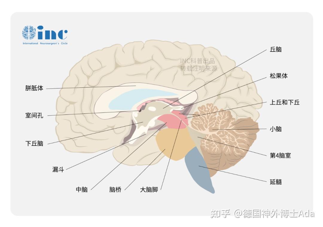 松果体区海绵状血管瘤的四大争议,成功全切手术案例