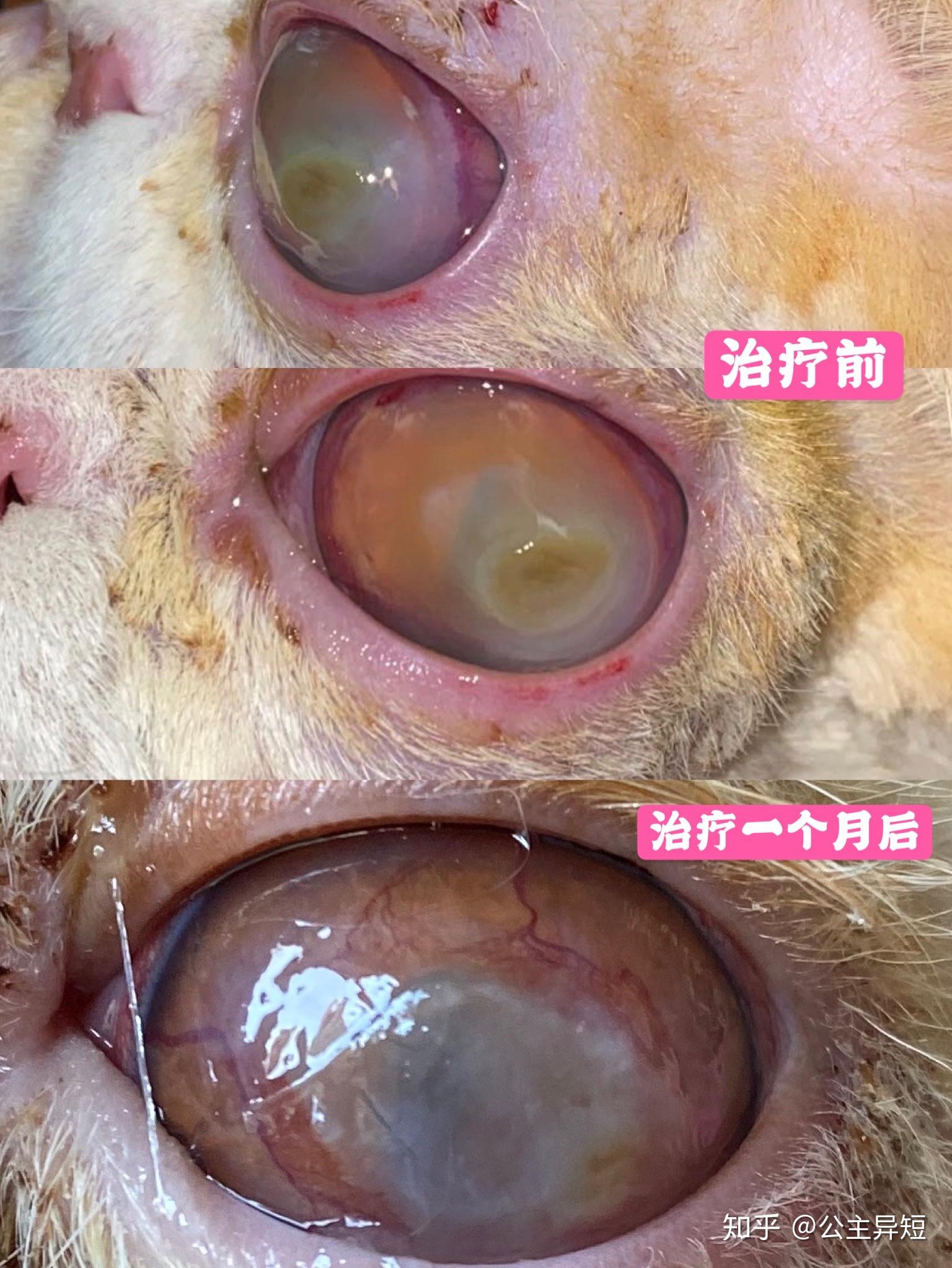 眼睛疾病治疗案例