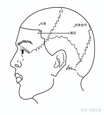 头皮针结构图图片