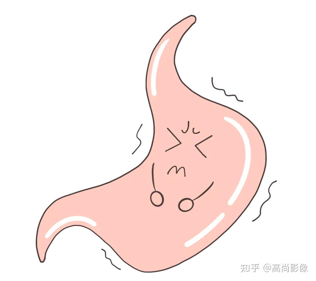 压力大,精神紧张,经常加班熬夜,很容易导致胃酸分泌过多,引起胃部不适