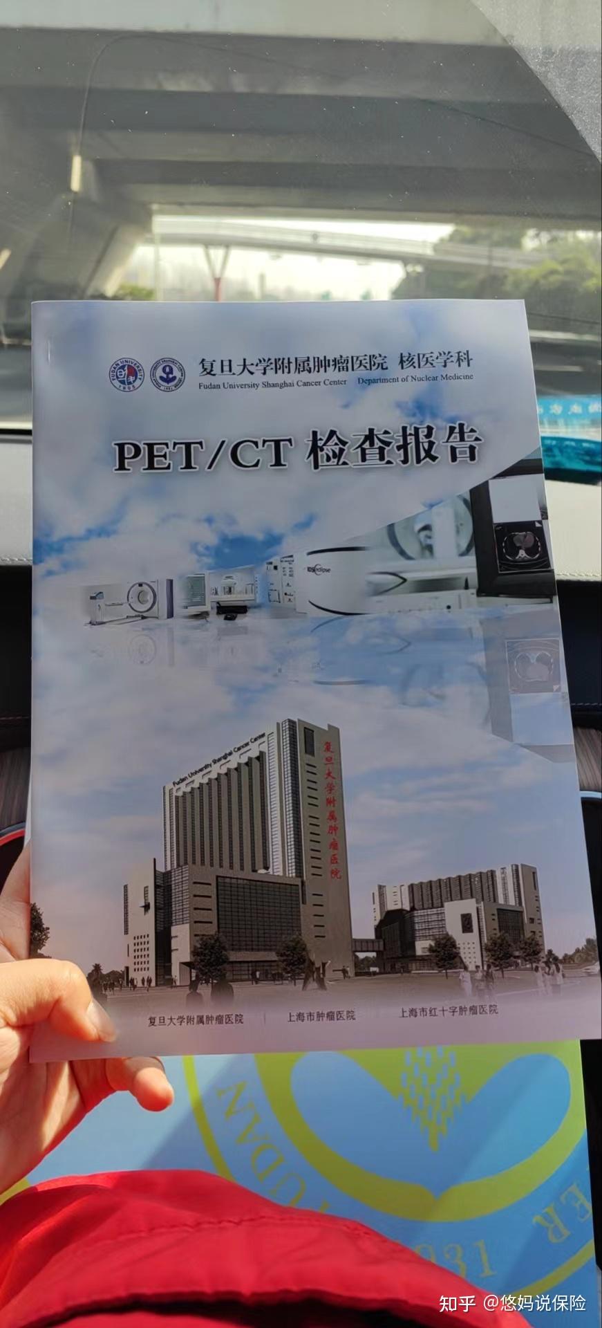 精原细胞瘤（睾丸癌）治疗全过程-分享给迷茫的病友 - 知乎