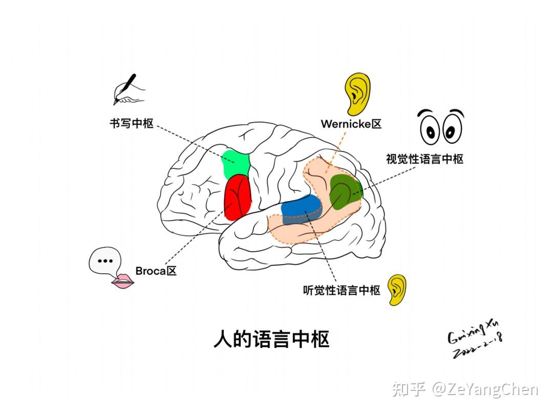 运动性失语 zhuanlan.zhihu.com