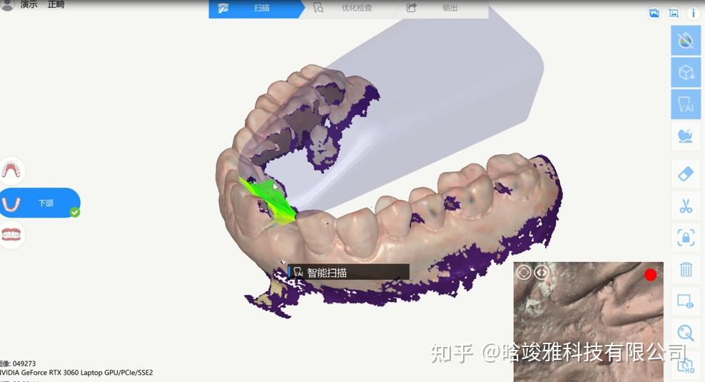 口扫有哪些智能工具 - 知乎