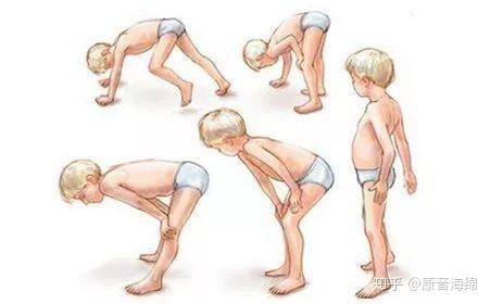 为什么肌营养不良走路会呈鸭步