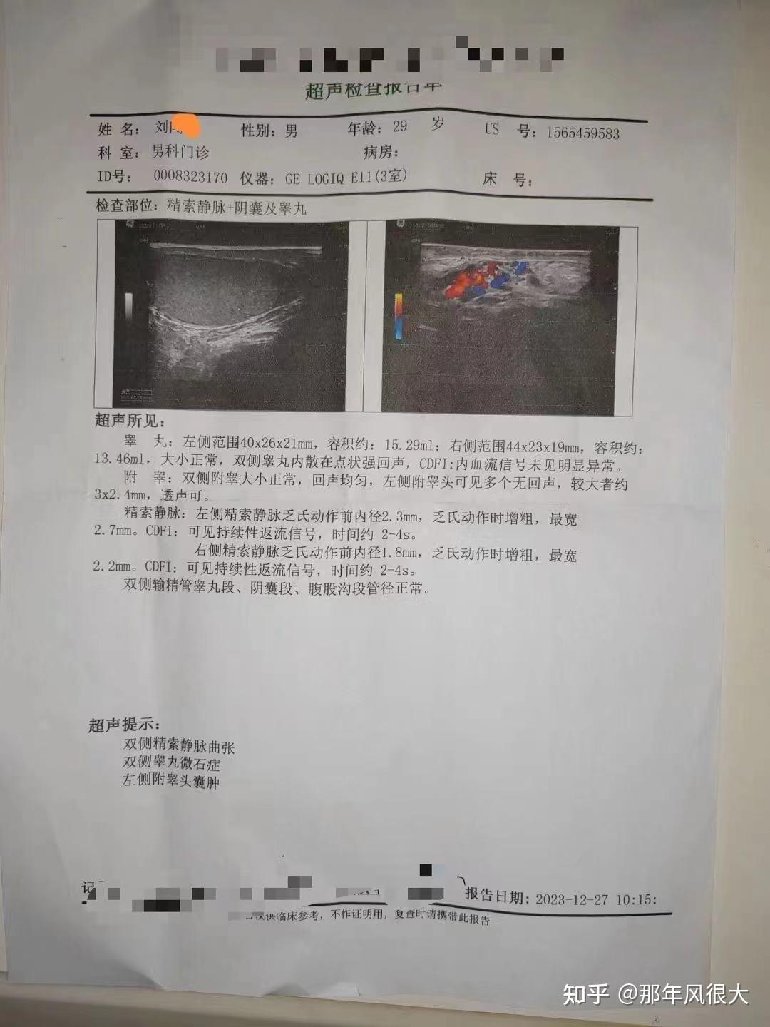 分享我治疗精索静脉曲张的坎坷历程