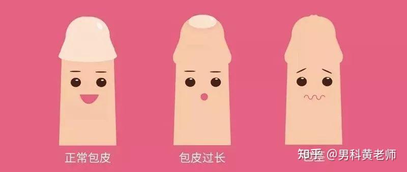 但是,成年人行包皮环切术不能预防阴茎癌.