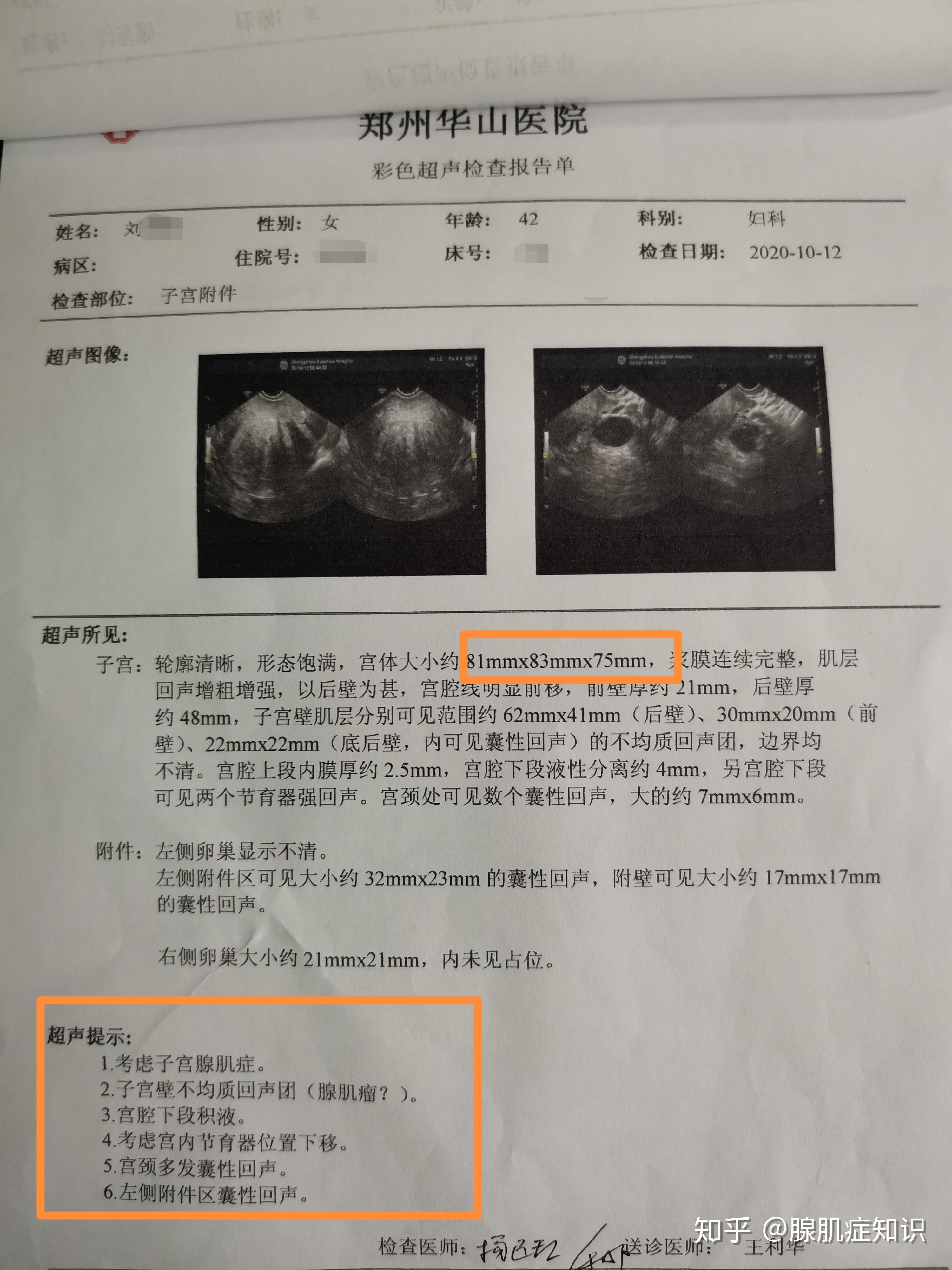 子宫腺肌症超声报告图片