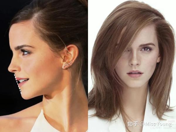 单眼皮、泪沟、凸嘴、方腮等,才是“小美女”的重中之重 - 知乎