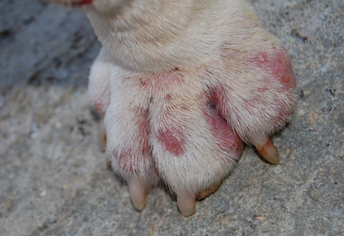 趾间炎是一种真菌感染疾病,有些也会混合细菌感染.