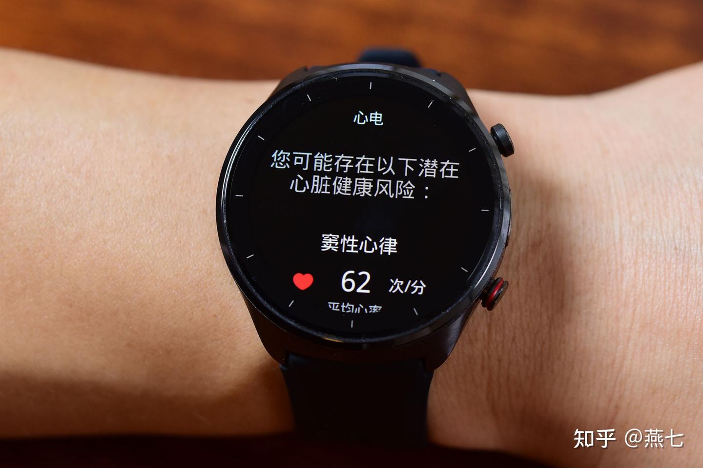 全天候心电守护+远程监测+一键求救!乐普W20智能健康手表体验