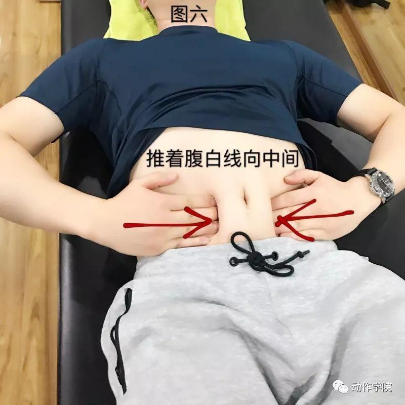 腹直肌操作手法