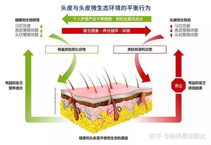 头皮亚健康的“元凶”找到了，让润氧秀来帮你！ 知乎