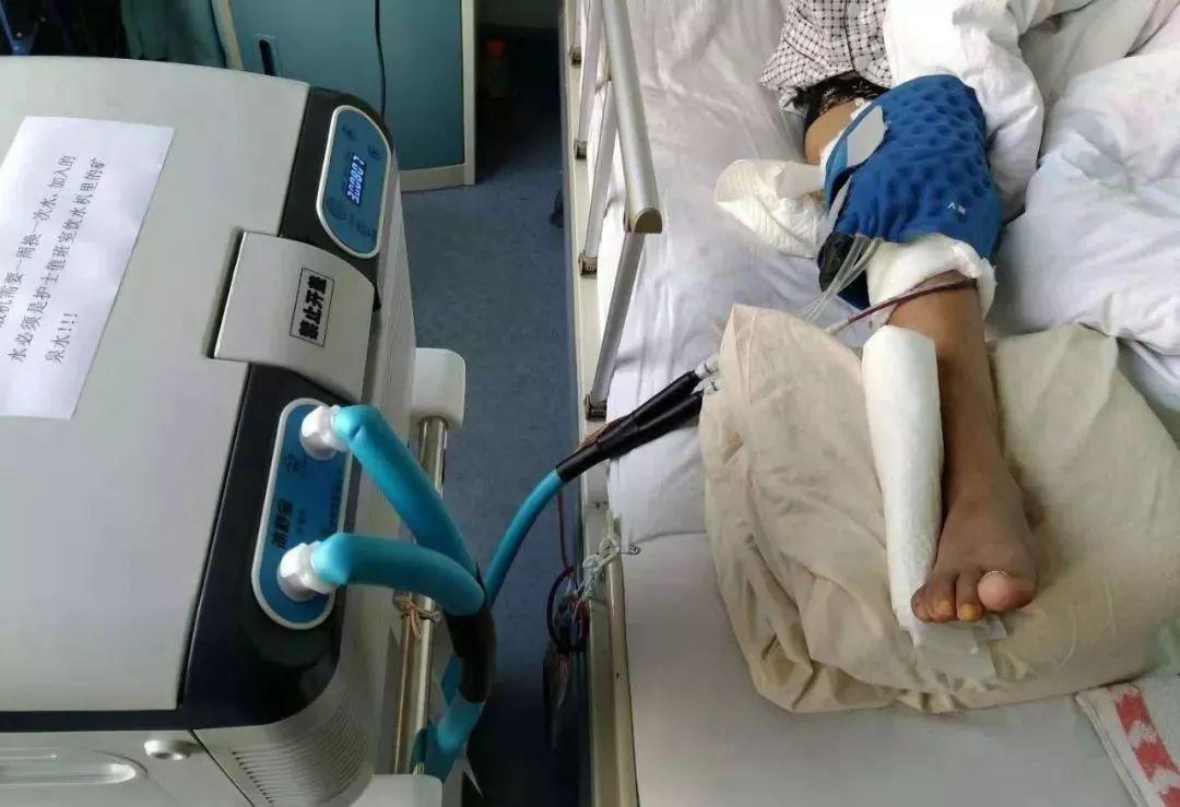 冷敷疗法在膝关节置换术后的临床应用