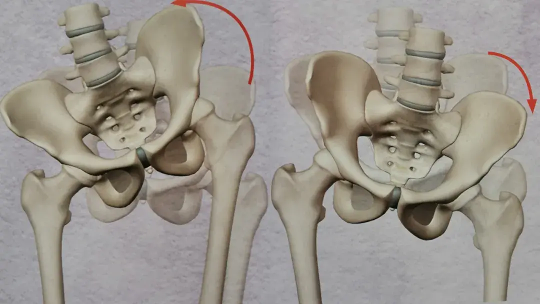 骨盆歪斜人群01这8种人不适合长时间行走一起来看看今天的文章吧如何
