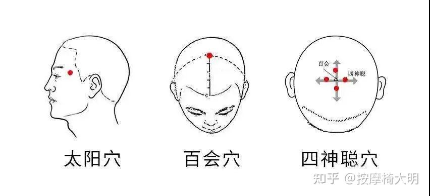 四神聪定位 头顶部