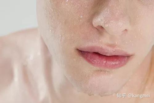 皮肤缺水紧绷起皮你该做哪些皮肤管理