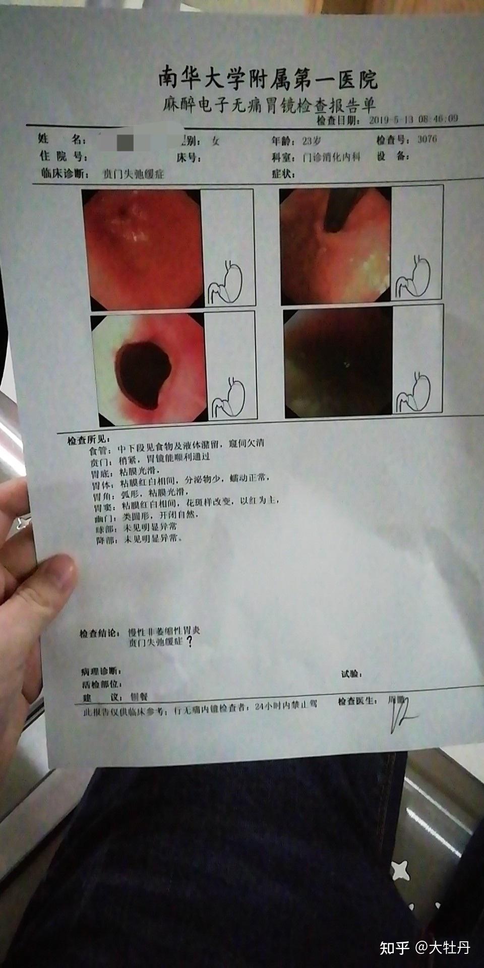 贲门失弛缓症住院日记