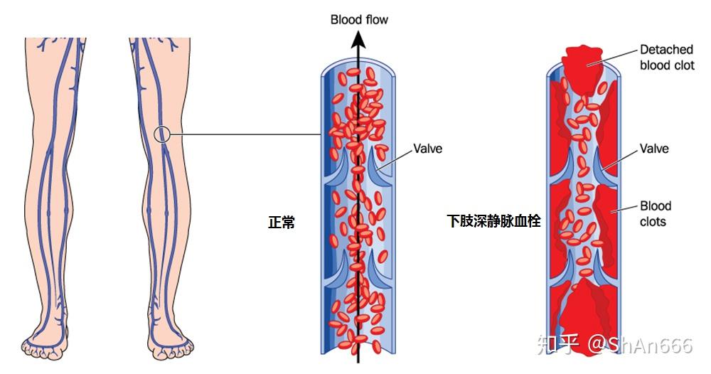 大腿血管分布图片