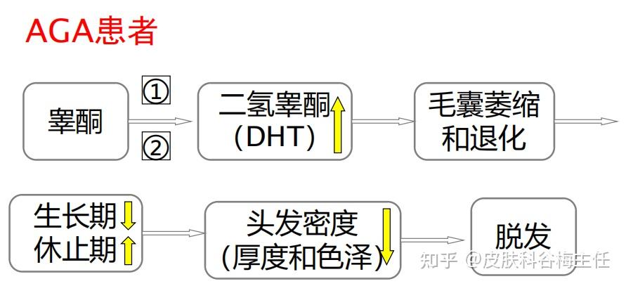 雄激素性脱发原理图片