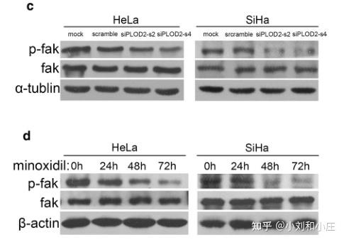 零基础SCI实验篇(22)western blot如何内参跑齐 - 知乎