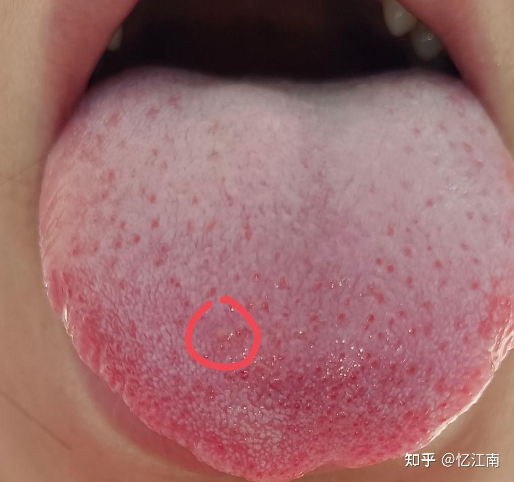 孩子舌头被咬了高清摄影大图-千库网