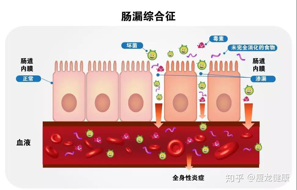 炎症，百病之源，如何消除炎症？ - 知乎