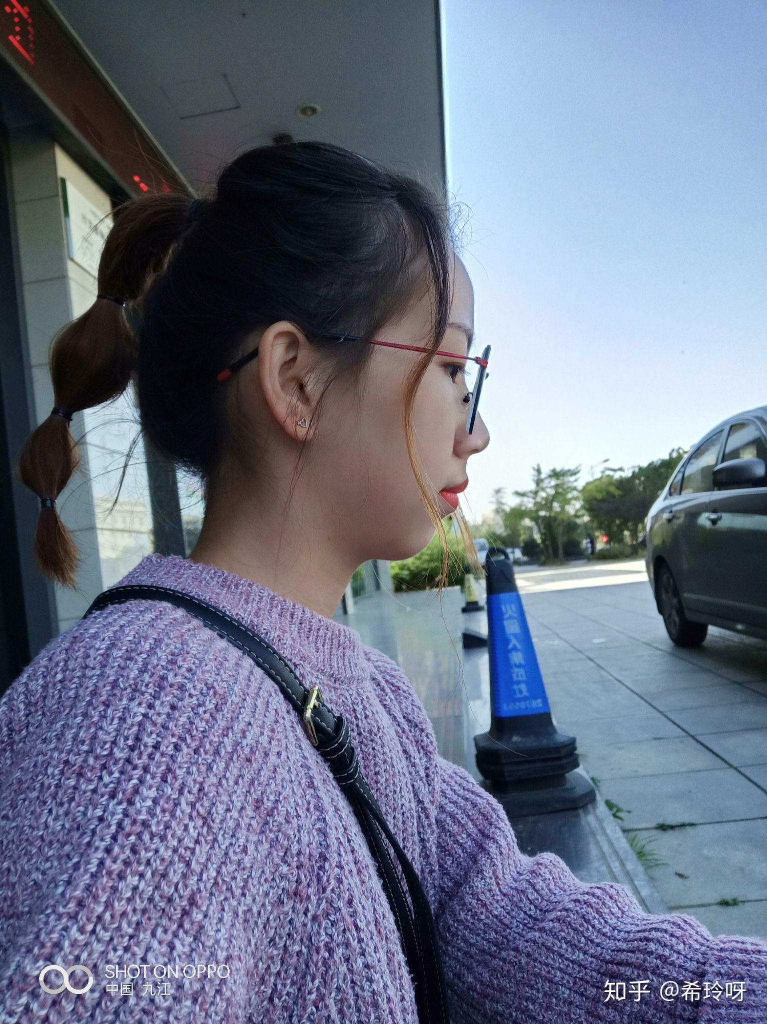 脸鼓没下巴的姑娘怎么变美?是不是没救了…?