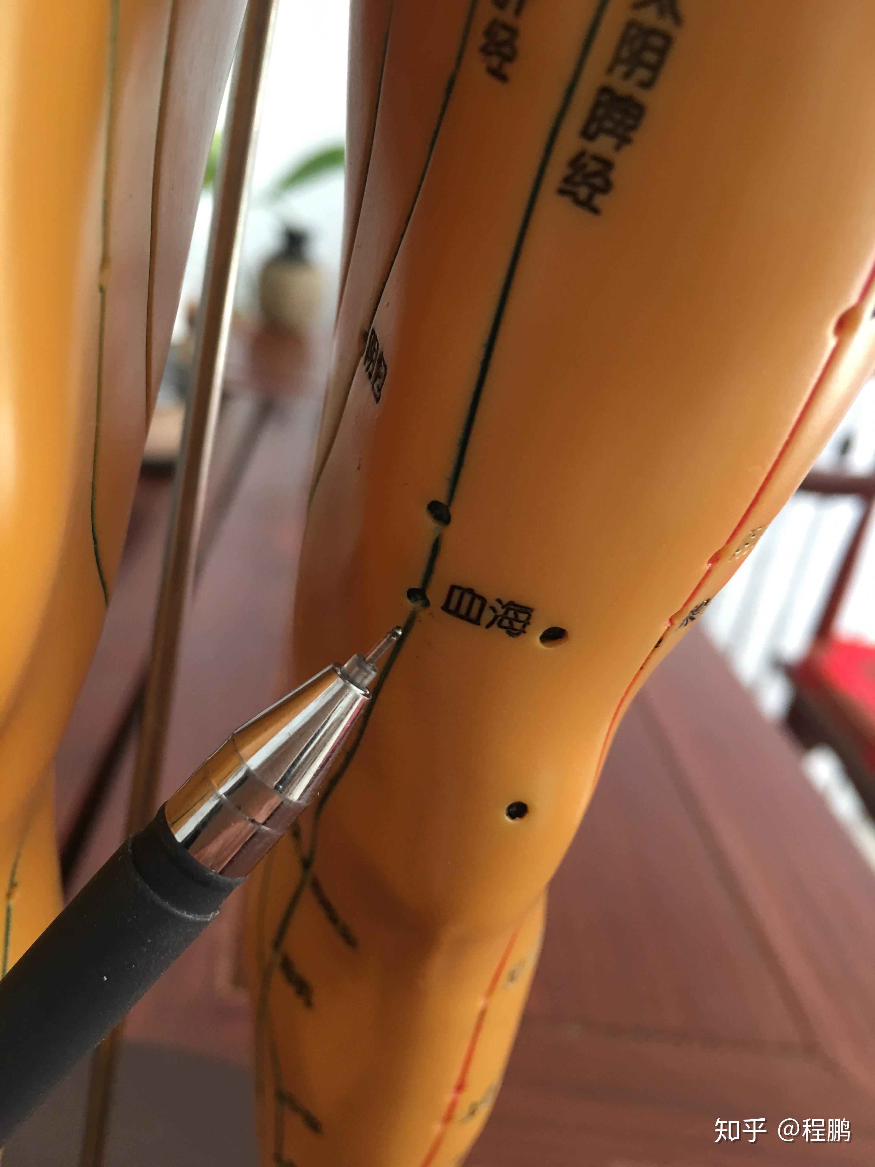 拔罐调理病症之~膝关节痛