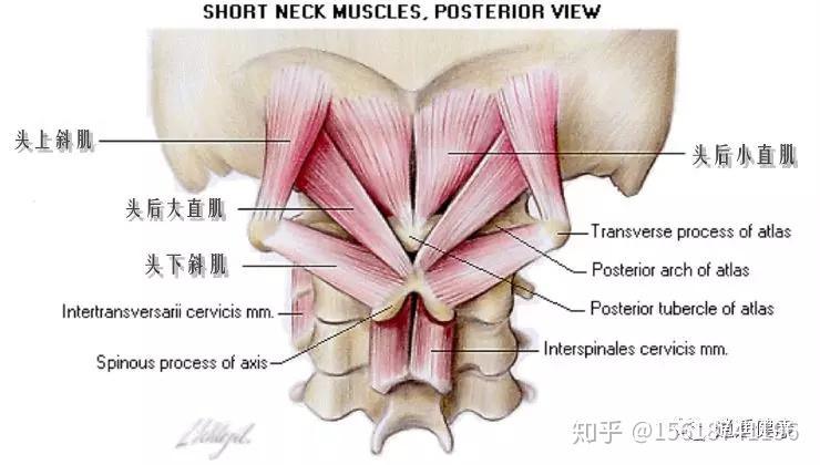 金門美兆診所 ''枕下肌症候群