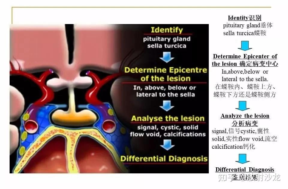 【收藏】蝶鞍及鞍旁区域解剖 - 知乎