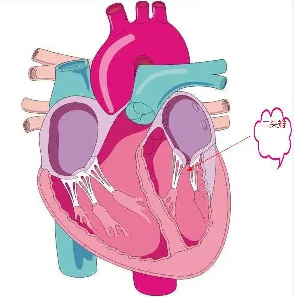 二尖瓣狭窄动画图片