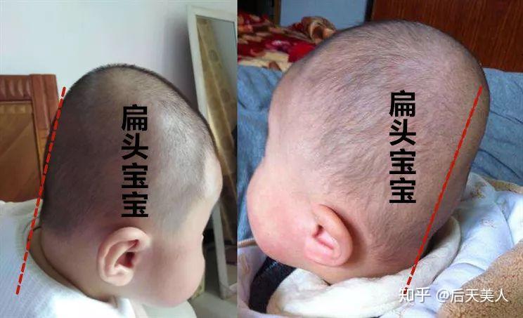 睡扁头都是谁的错?(刘昊然告诉你:你为什么头大) - 知乎