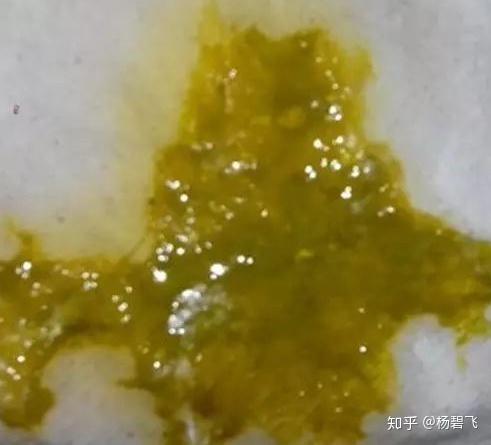 婴幼儿大便识别详解（超级实用） - 知乎