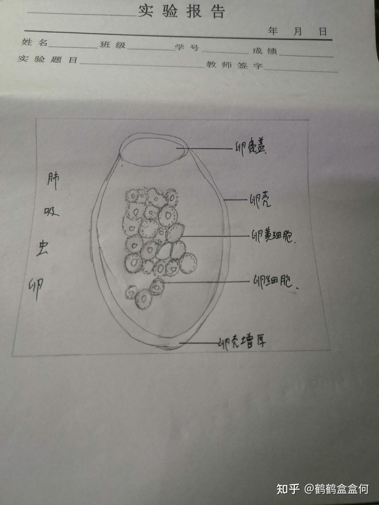 中性分叶核粒细胞绘图图片