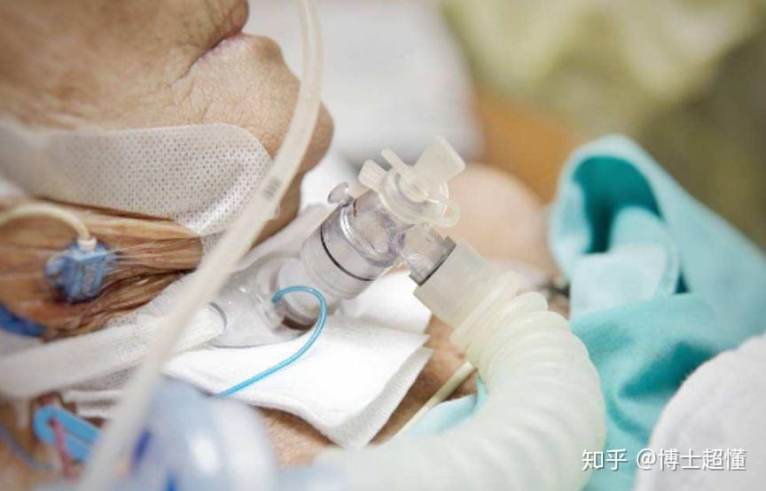 让各国抢破头的呼吸机究竟为什么那么紧缺