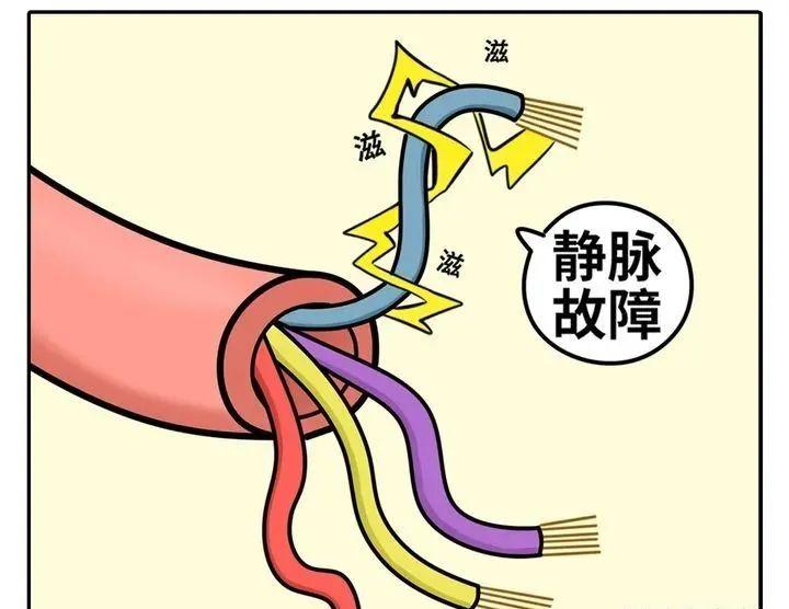 精索静脉曲张的蛋蛋是怎么回事? - 知乎