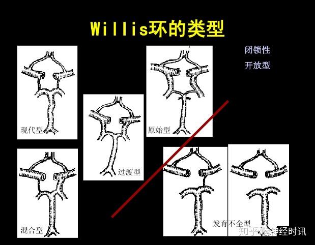 是頸內動脈系,椎一基底動脈還是連接他們的willis環均位於腦的腹側面