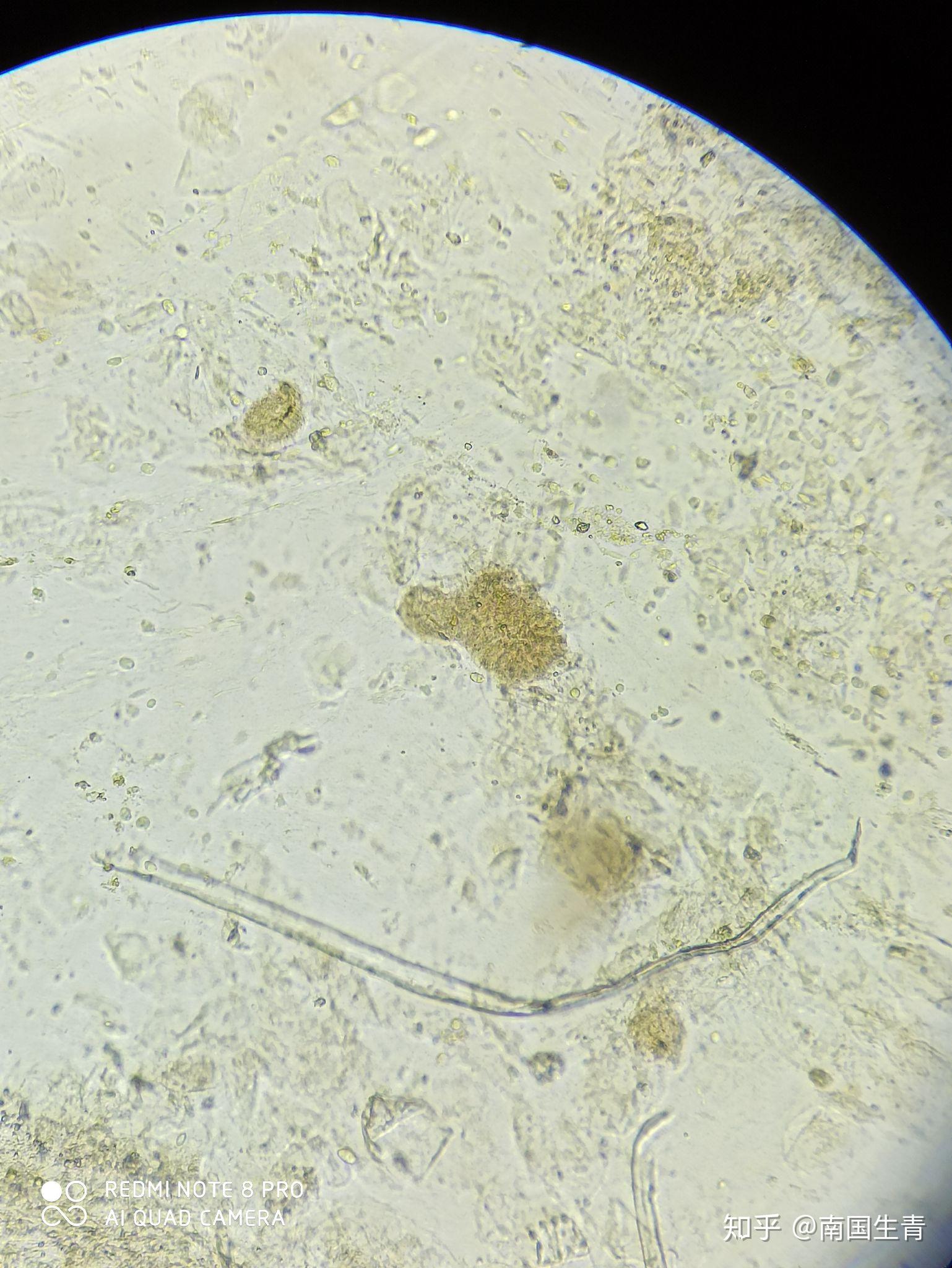 顯微鏡圖片與視頻請問這裡面有寄生蟲或者蟲卵嗎