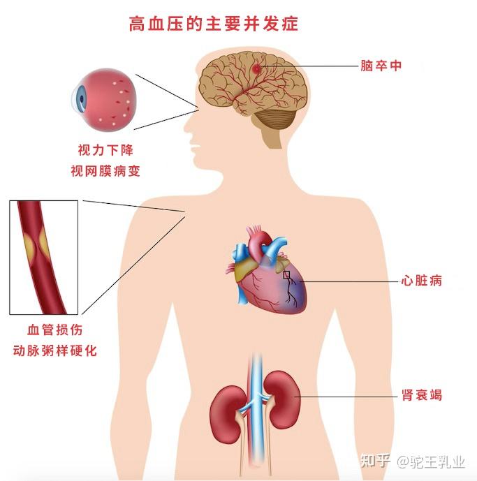 高血压的危害超出你的想象