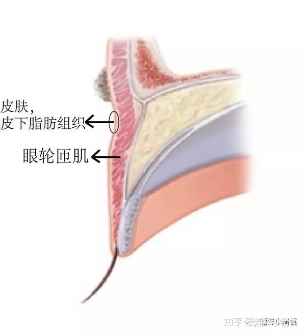 前层:皮肤,皮下脂肪,以及 眼轮匝肌