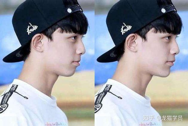 有哪些明星有颌面问题比如地包天