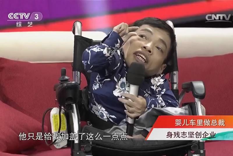 同时患上侏儒症和脆骨病,5岁时父亲去世