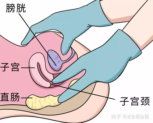 双合诊 手法图片