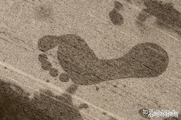 4招教你自我检测及矫正是否扁平足