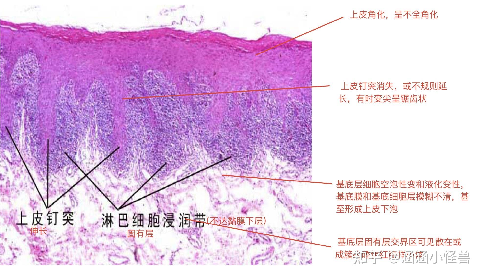 口腔组织病理学-镜下观察 - 知乎