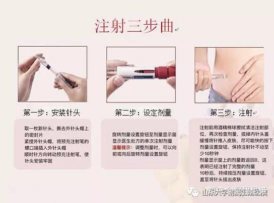 促排卵药物(果纳芬)的注射方法及注意事项