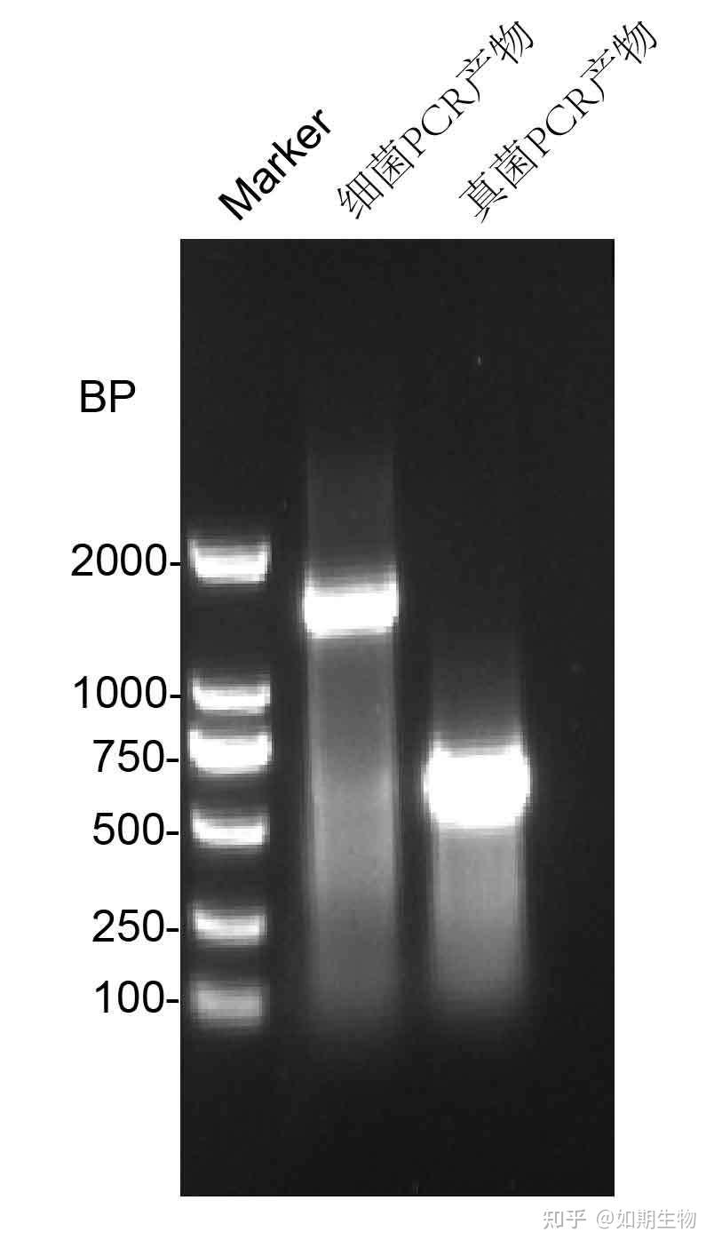 16s rrna 
